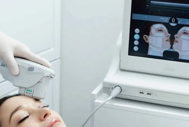 ultherapy with AI